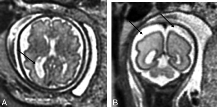 Fig 1.