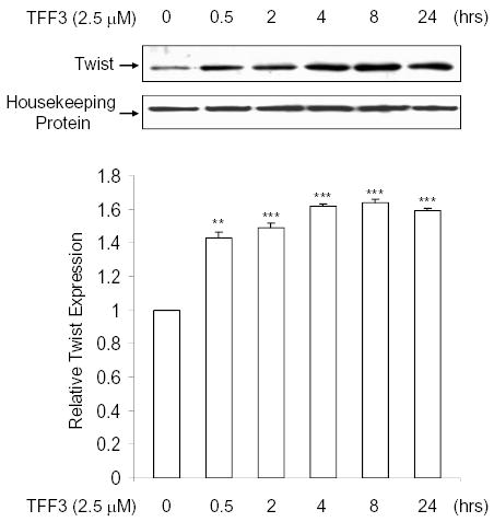 Trefoil factor 3 modulates NF-κB and a novel negative regulatory ...