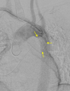 Fig. 2A