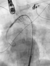 Fig. 2B
