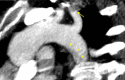 Fig. 1B
