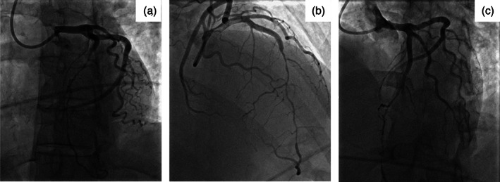 FIGURE 3