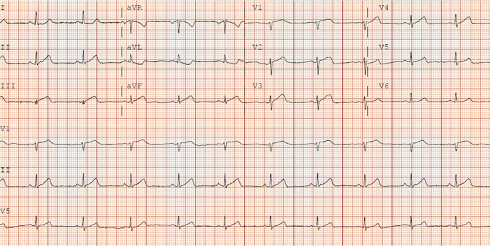 FIGURE 2