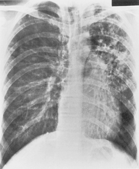 Figure 3-24