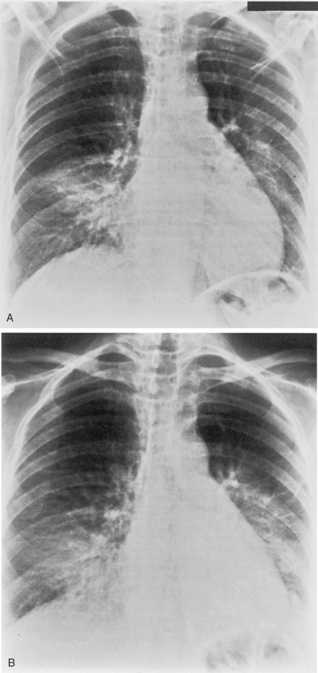 Figure 3-16