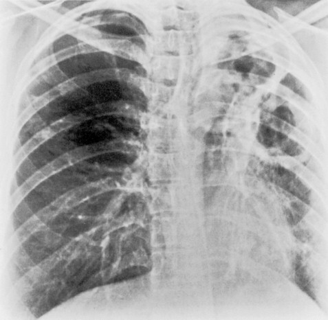 Figure 3-25