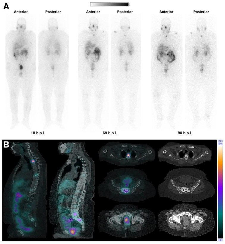 Figure 14