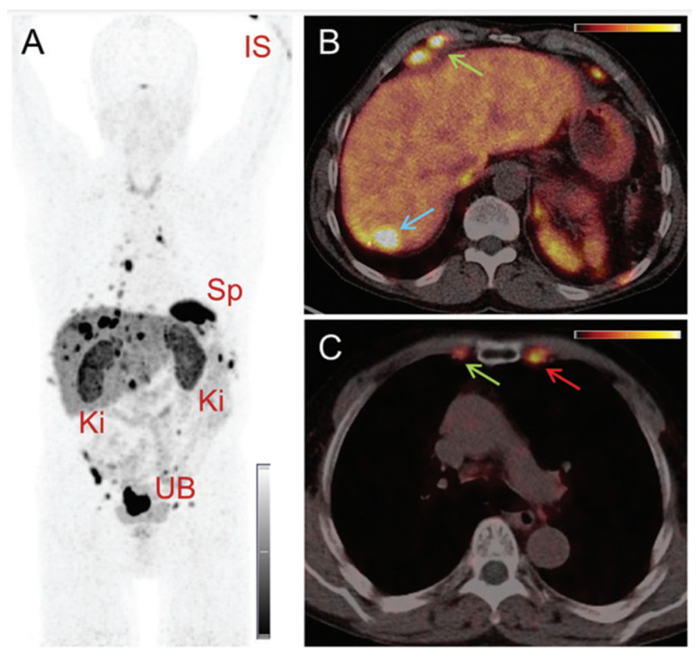 Figure 11