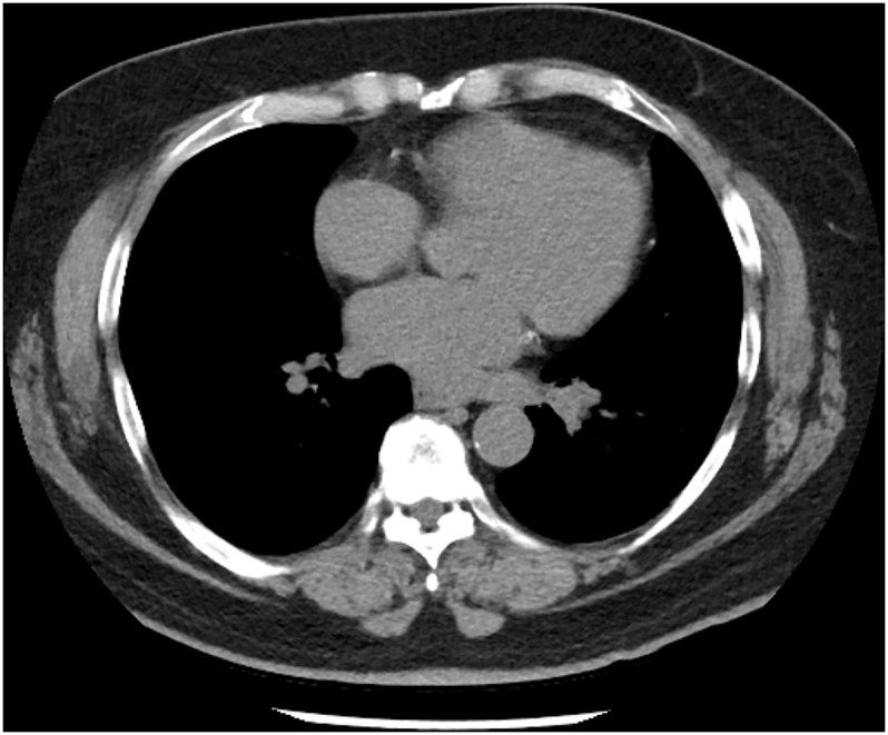 Fig. 1B