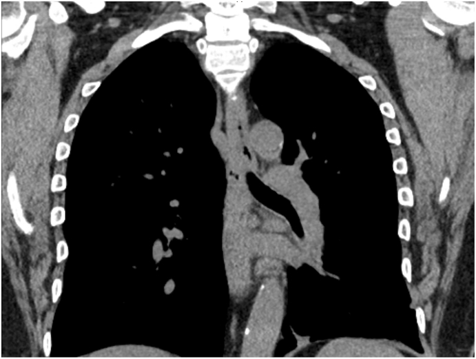 Fig. 1C