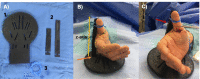 Fig. 1