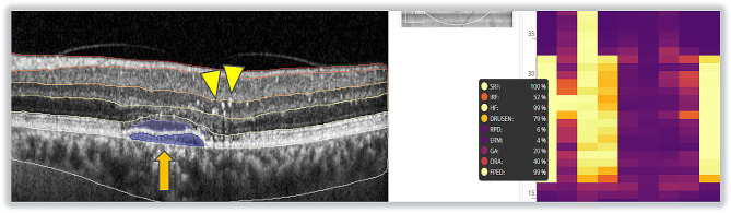 Fig. 2