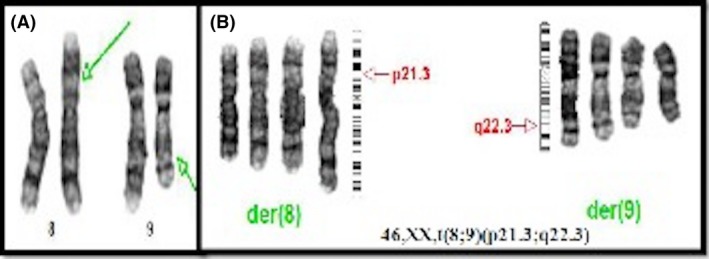 Figure 9