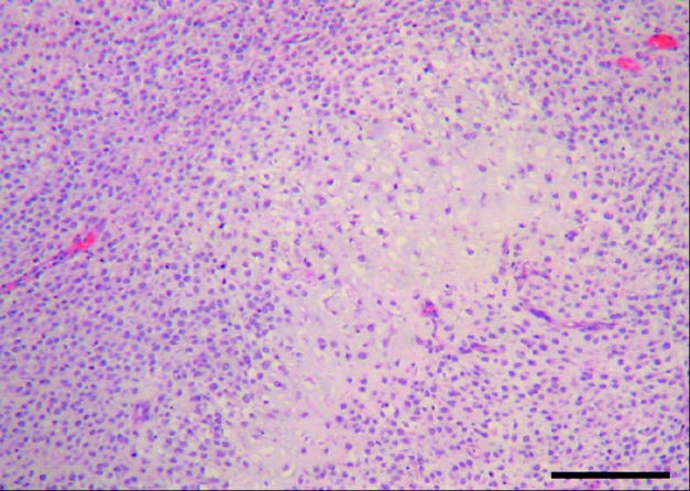 Primary splenic mesenchymal chondrosarcoma in a dog - PMC