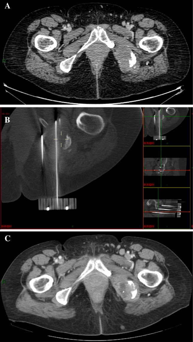 Fig. 4