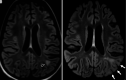 Figure 13.