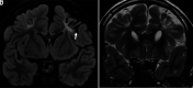 Figure 12.