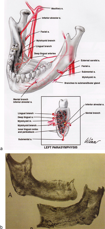 Fig. 13