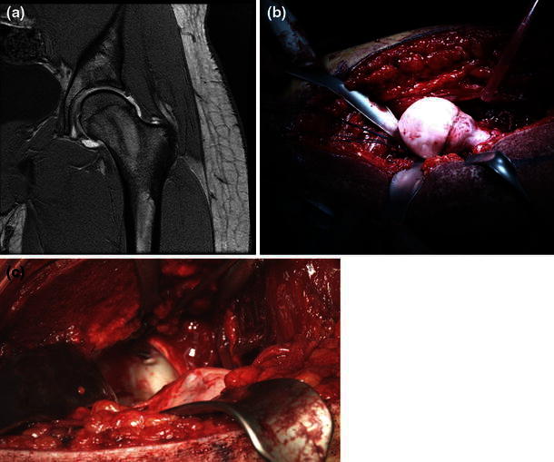 Fig. 1