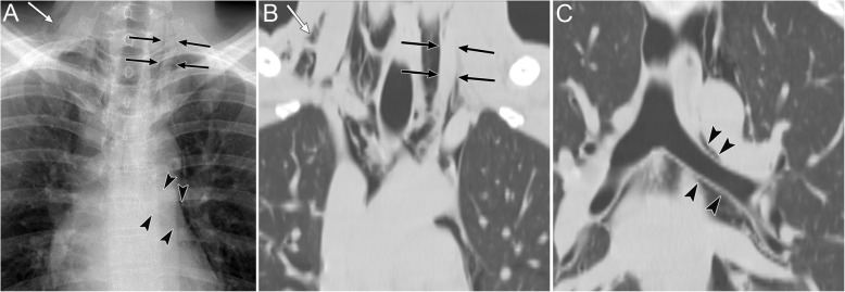 Fig. 13