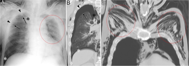 Fig. 5