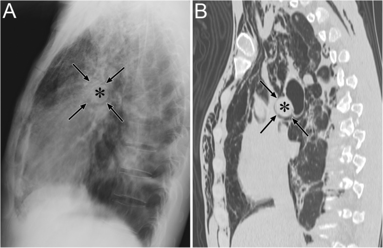 Fig. 14