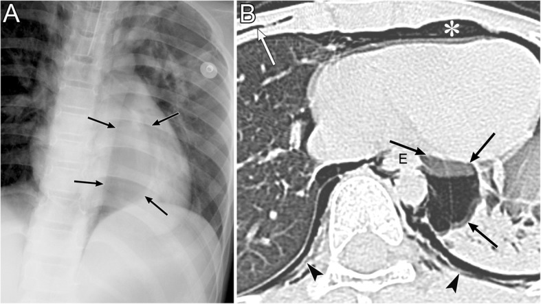 Fig. 18