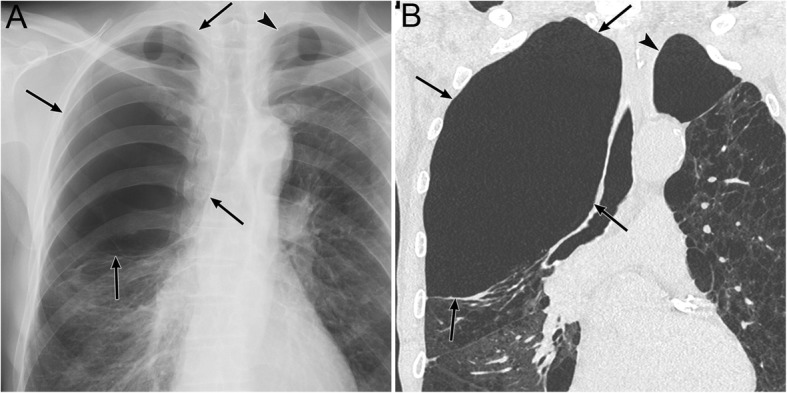 Fig. 10