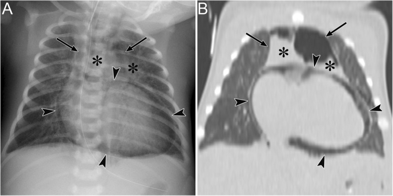 Fig. 15