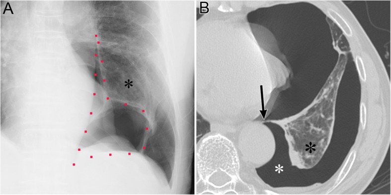 Fig. 6