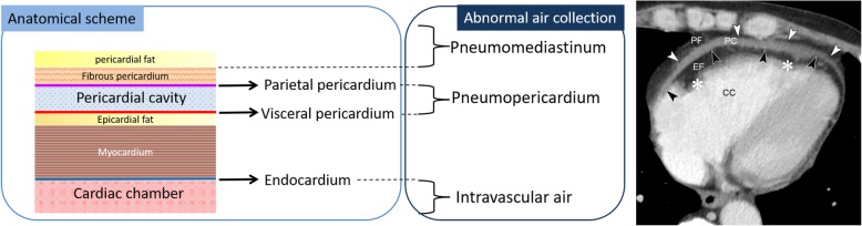 Fig. 12