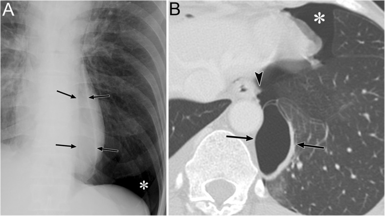 Fig. 19