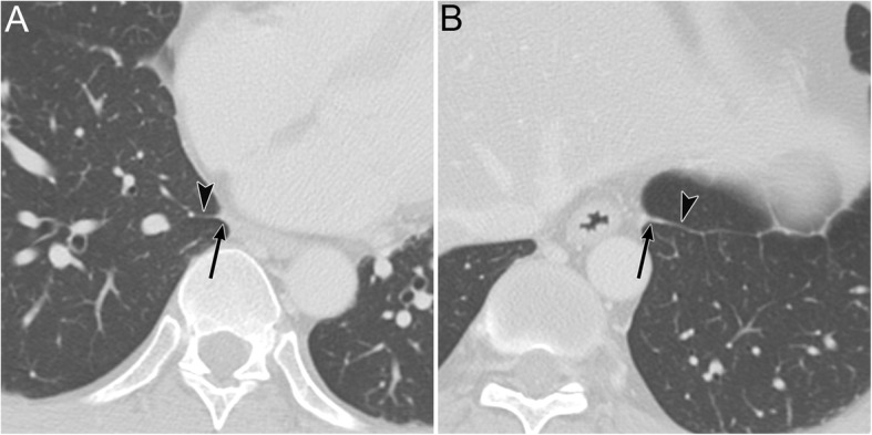 Fig. 17