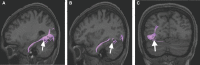 FIGURE 26.