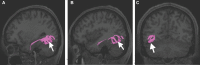 FIGURE 18.