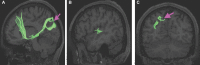 FIGURE 32.