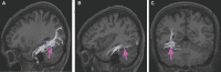 FIGURE 20.