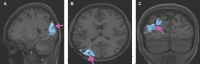 FIGURE 42.