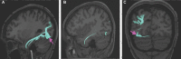 FIGURE 14.