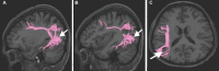 FIGURE 56.