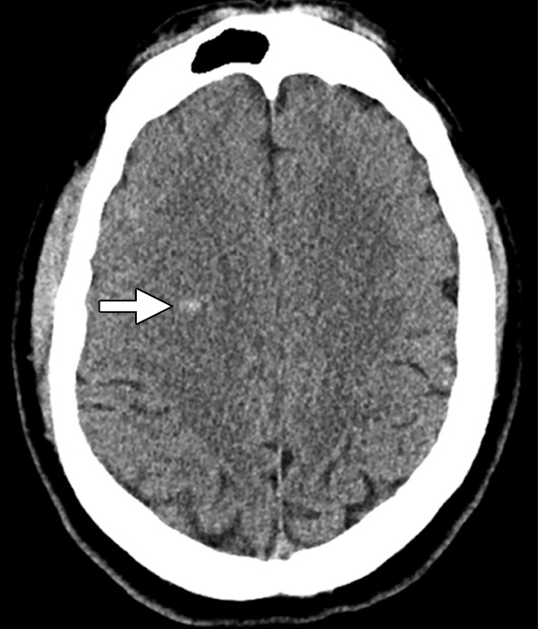 Figure 5a: