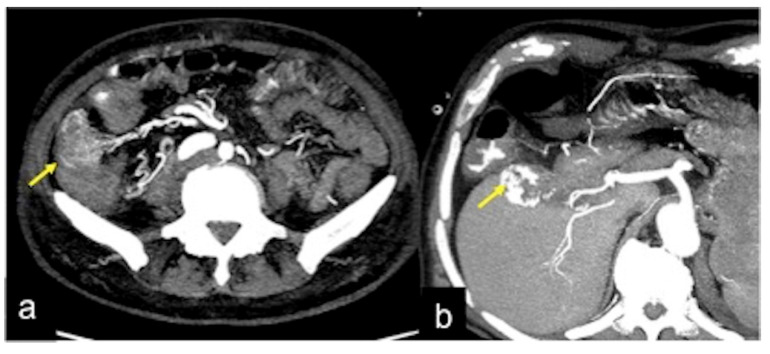 Figure 34