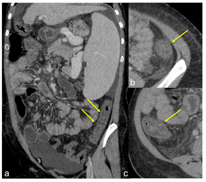 Figure 41