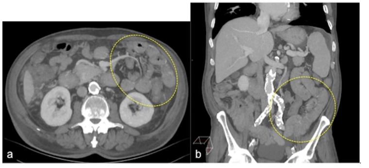 Figure 18