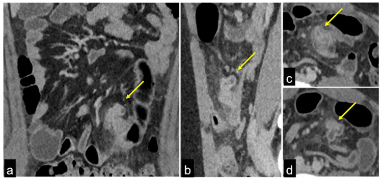 Figure 30