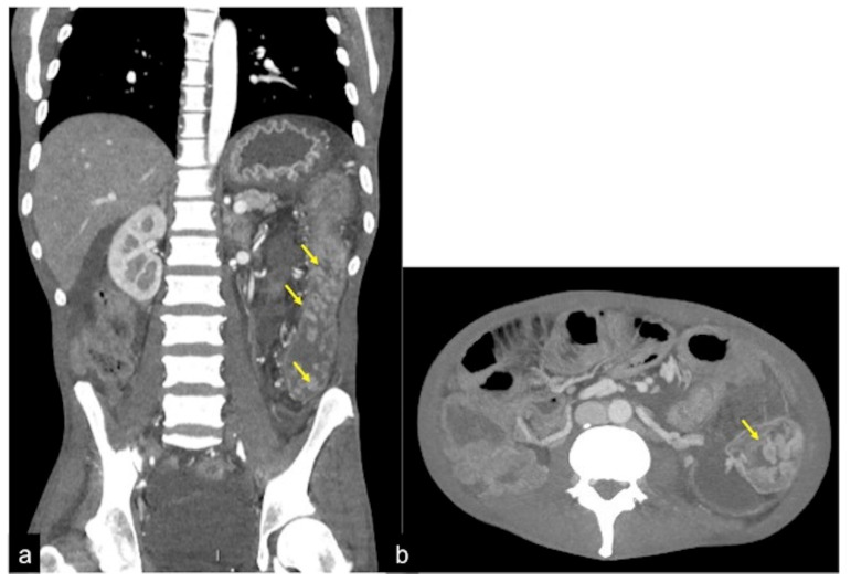 Figure 37