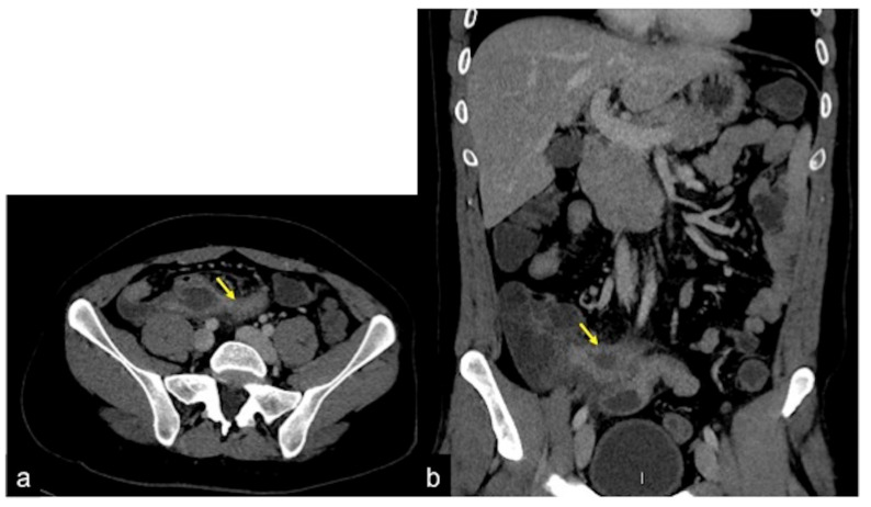 Figure 39