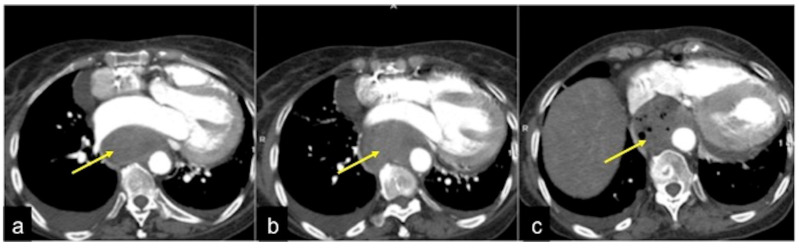 Figure 22