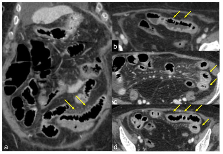 Figure 40