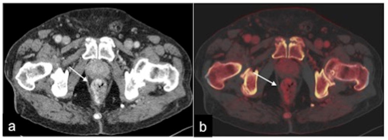 Figure 35